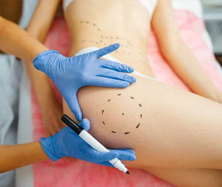 cosmetician-with-marker-puts-dotted-lines-on-body-46BU9A4