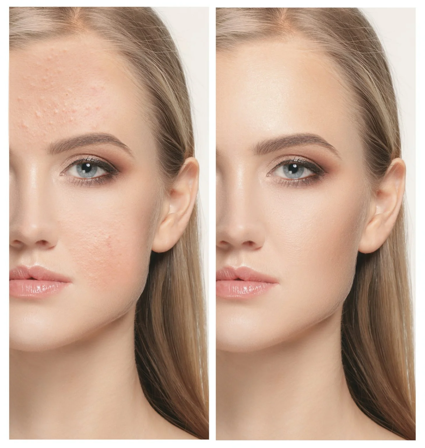 woman-before-and-after-treatment-1458x1536
